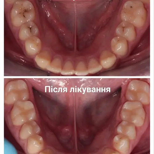 Лікування