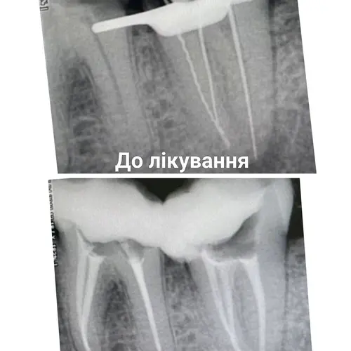 Лікування