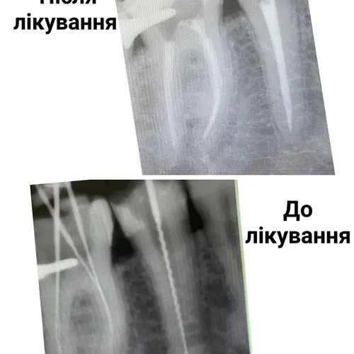 Лікування