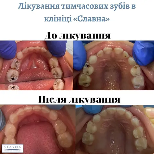 Лікування