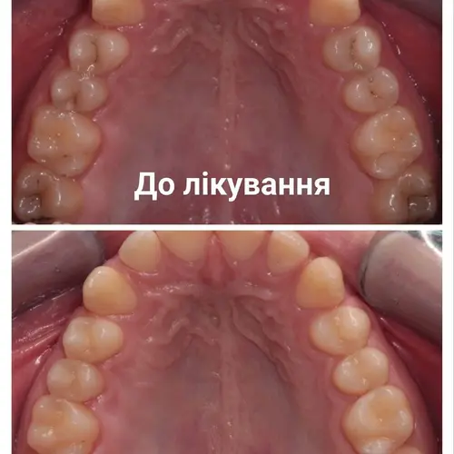 Лікування