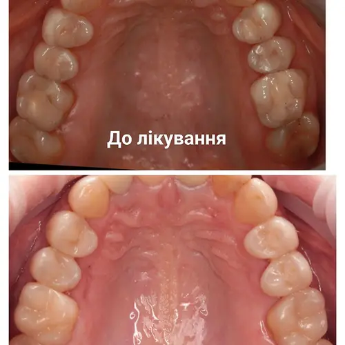 Лікування