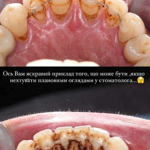 Професійна гігієна