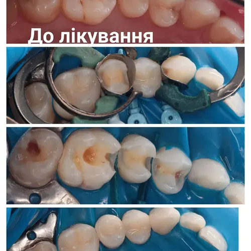 Лікування