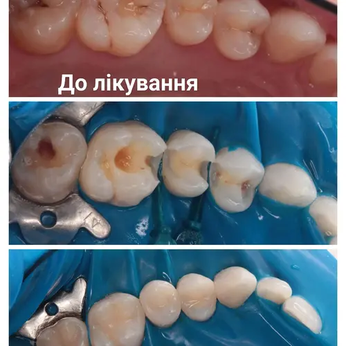 Лікування