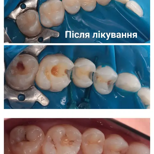 Лікування